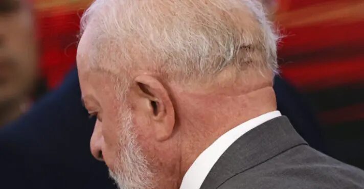 Lula vai passar por nova cirurgia nesta quinta-feira