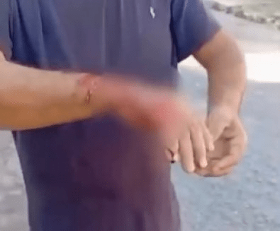 Piitbull foge de casa, mata cachorra e deixa morador ferido em MT