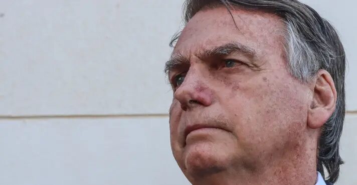Bolsonaro deixa hospital depois de procedimento para remover lesões na pele