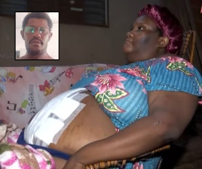 Mulher esfaqueada pelo ex-marido relata trauma: “qualquer barulho me assusta”