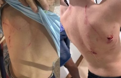 Cão da raça rottweiler é capturado após atacar crianças em praça de MT