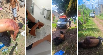 Agressor arranca dedo de mulher e toma “salve” de faccionados do CV